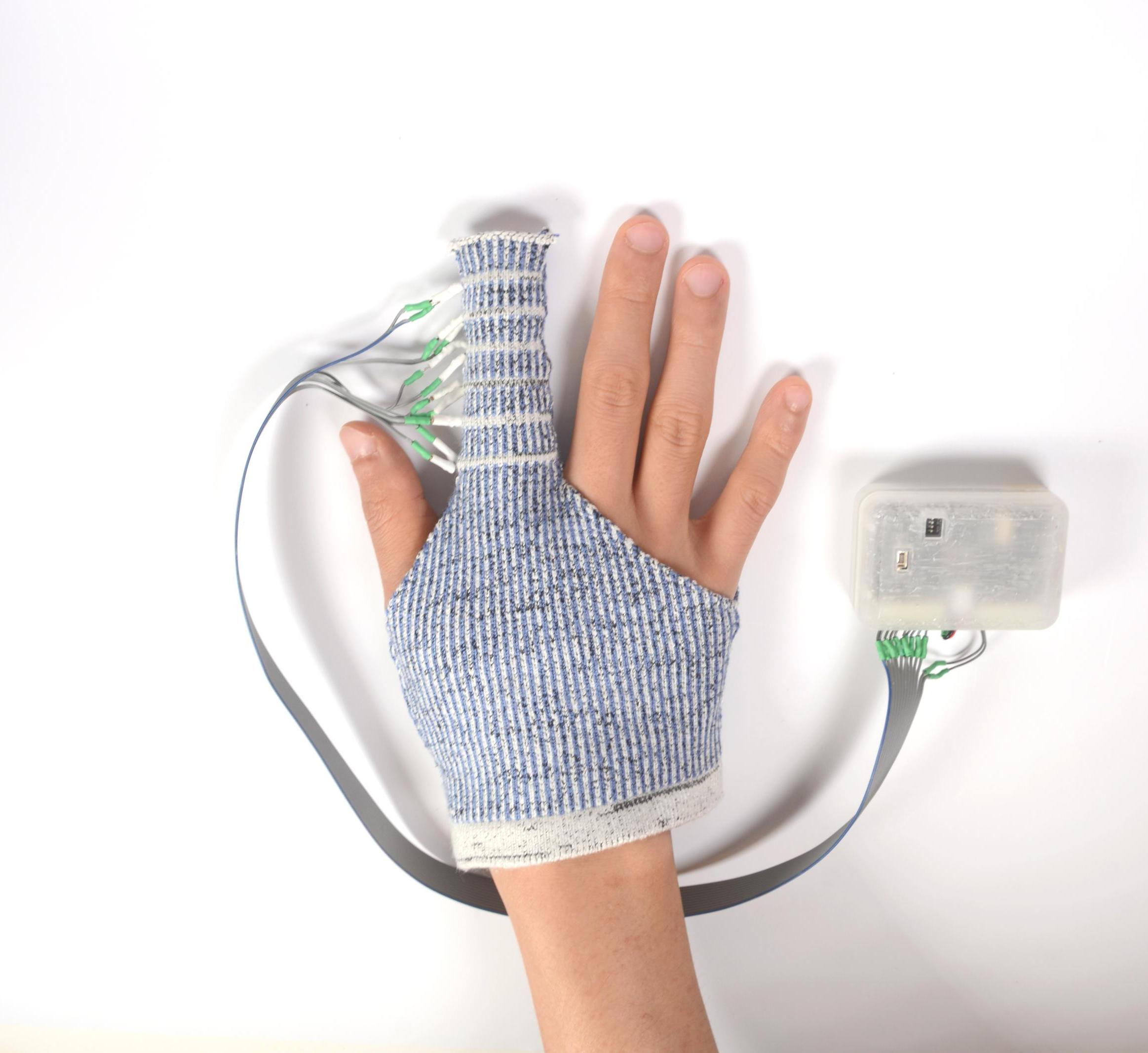 KnitDema (knitted glove with robotics to massage with hand patients withhand edema 