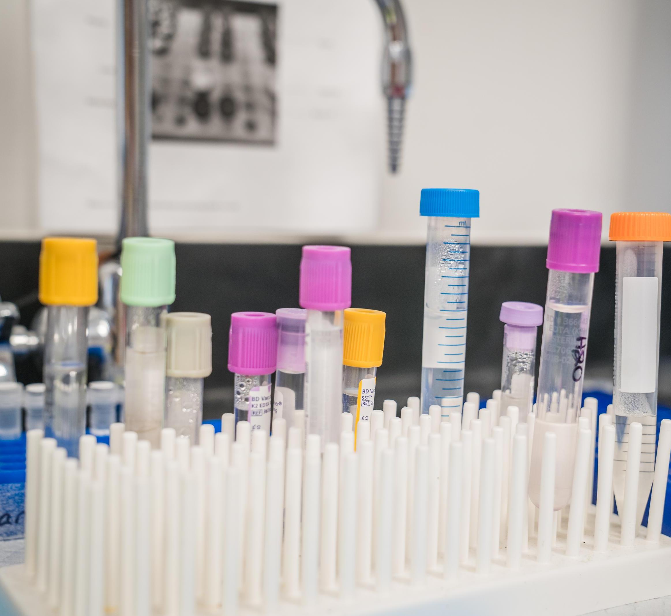 pipettes in a lab 