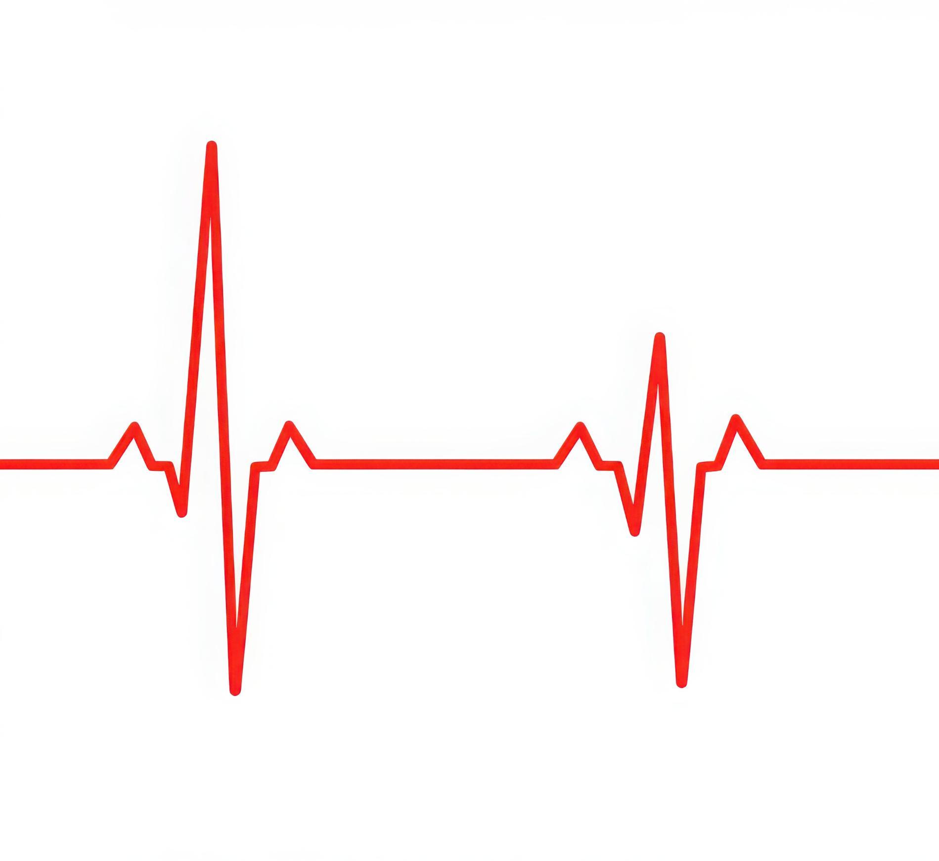 image of a heartbeat read out 