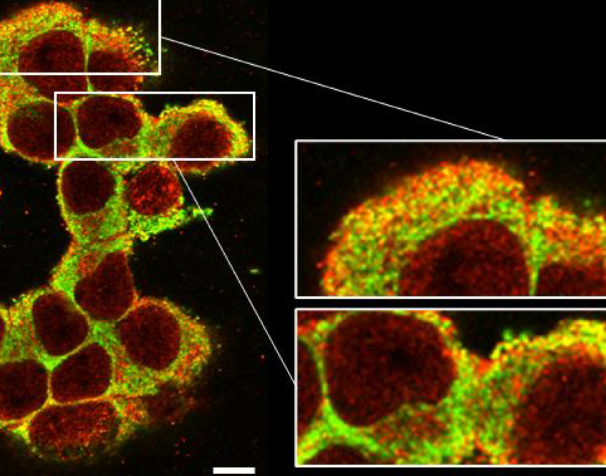 Pancreatic beta cells