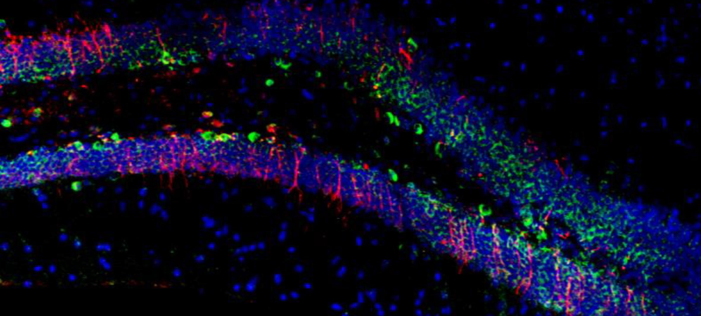 molecular image of brain cells