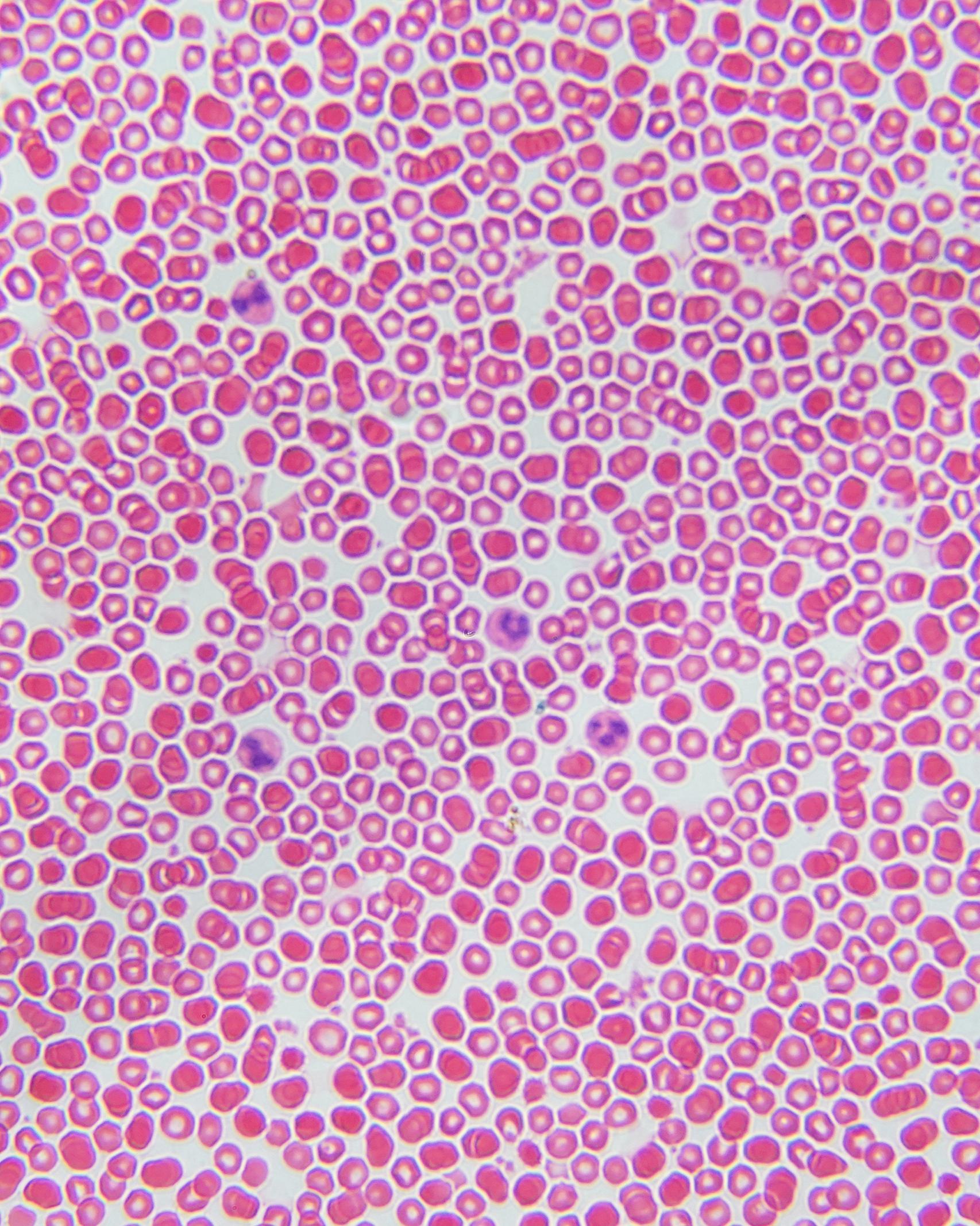 microscopic view of pink and red blood cells
