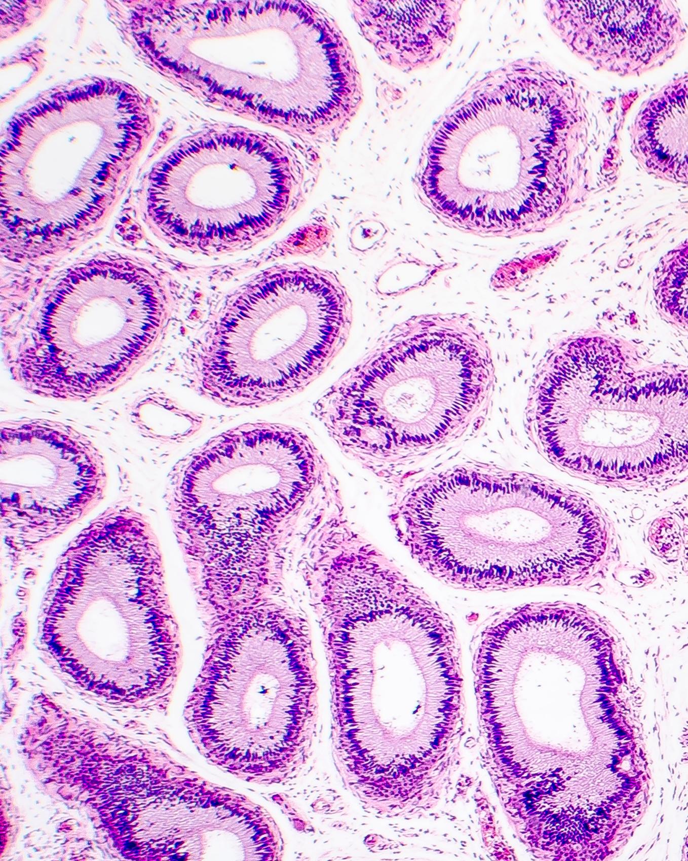 microscopic view of pink and purple stained human epididymis tissue