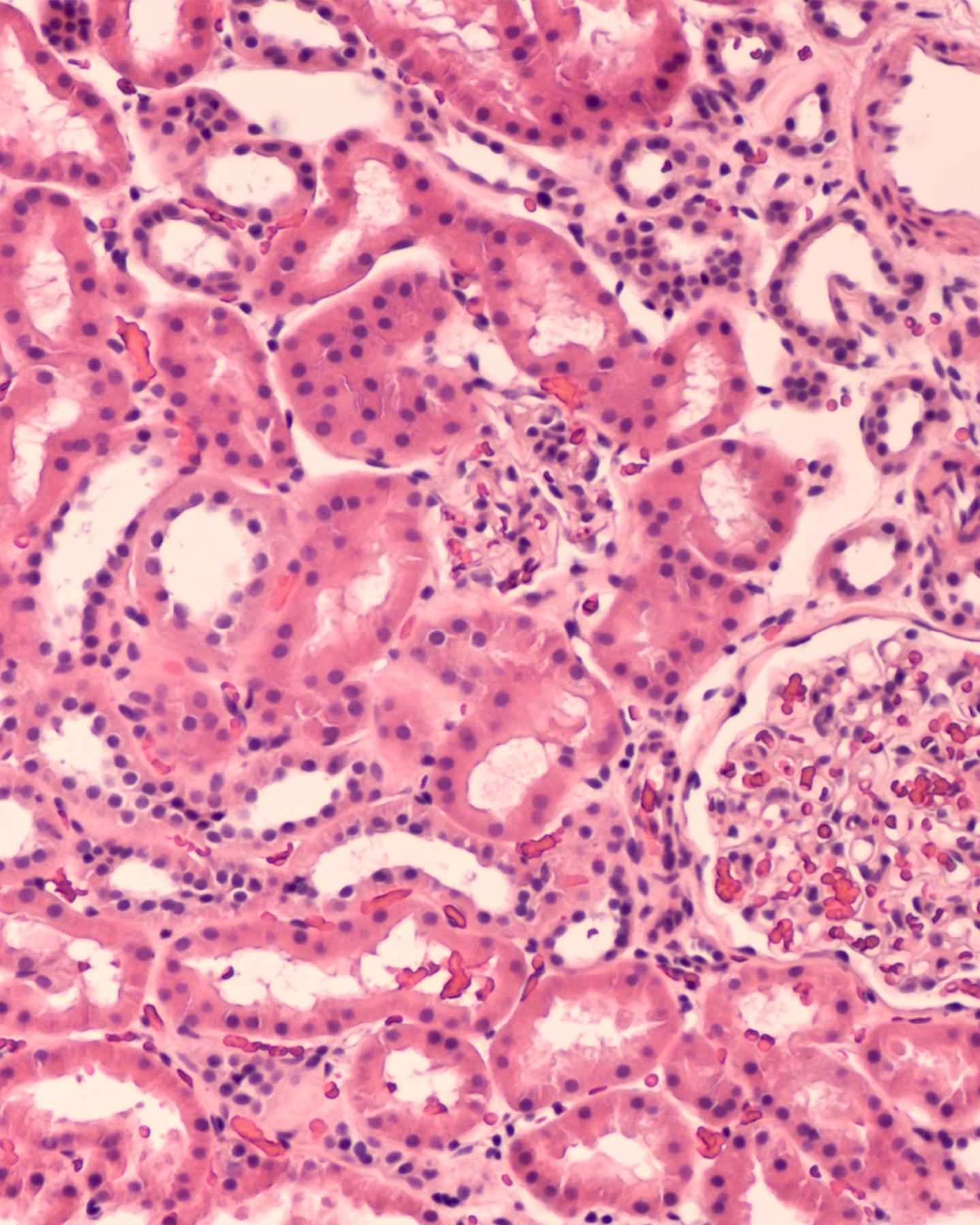 microscopic view of human kidney tissue