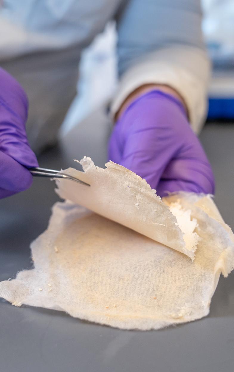 purple-gloved hands use tweezers to pull back a layer of off-white papery material