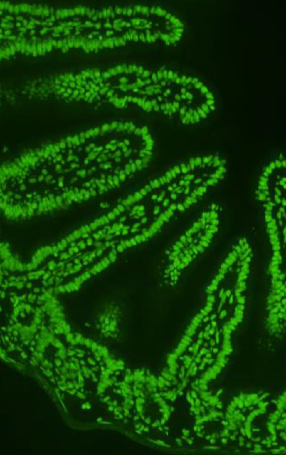 Molecular image of an intestines